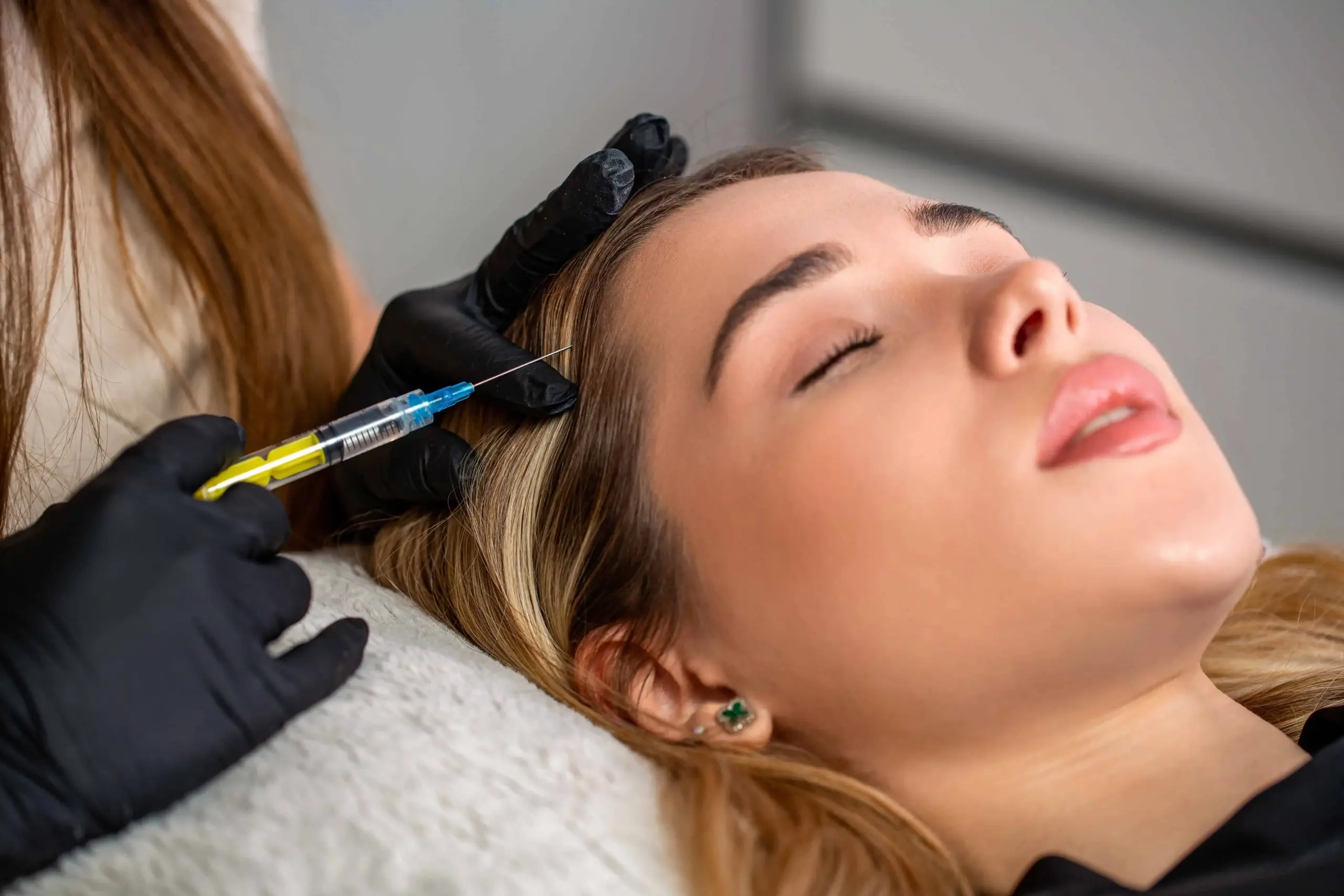 Woman receiving hair restoration injection treatment for thinning hair